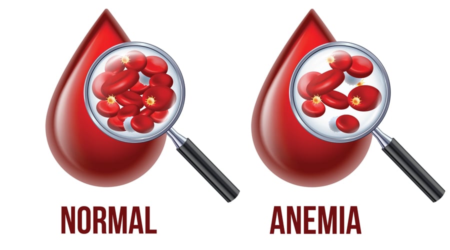 Iron's role in preventing anemia